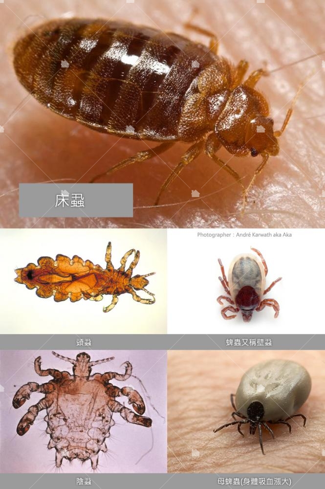 會寄生在人身上的蝨子:頭蝨、陰蝨,還有常寄生在貓狗身上的壁蝨 ─ 蜱蟲。 會寄生在人身上的蝨子:頭蝨、陰蝨,還有常寄生在貓狗身上的壁蝨 ─ 蜱蟲。